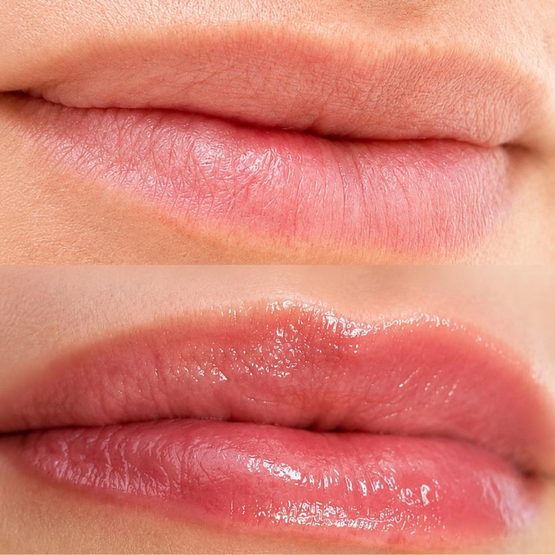 Hydragloss
